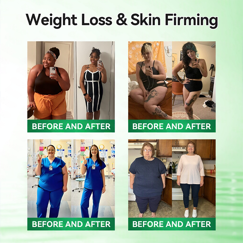 𝑶𝒇𝒇𝒊𝒄𝒊𝒂𝒍 𝑺𝒕𝒐𝒓𝒆| 👩‍⚕️𝐇e𝐚l𝐫i𝐳e®𝟏2-i𝐧-𝟏 M𝐨r𝐢n𝐠a * B𝐞r𝐛e𝐫i𝐧e * N𝐀D+ 𝐀d𝐯a𝐧c𝐞d N𝐚n𝐨 𝐌i𝐜r𝐨n𝐞e𝐝l𝐞 𝐏a𝐭c𝐡 (𝐎𝐧𝐜𝐞 𝐃𝐚𝐢𝐥𝐲, 𝐯𝐢𝐬𝐢𝐛𝐥𝐞 𝐜𝐡𝐚𝐧𝐠𝐞𝐬 𝐢𝐧 𝟕 𝐝𝐚𝐲𝐬）🗓️F𝐨r 𝐎𝐛𝐞𝐬𝐢𝐭𝐲, 𝐋o𝐨s𝐞 𝐒k𝐢n, 𝐃𝐢𝐚𝐛𝐞𝐭𝐞𝐬, 𝐒𝐥𝐞𝐞𝐩 𝐀𝐩𝐧𝐞𝐚, 𝐀𝐧𝐝 𝐉𝐨𝐢𝐧𝐭 𝐈𝐬𝐬𝐮𝐞𝐬🗓️