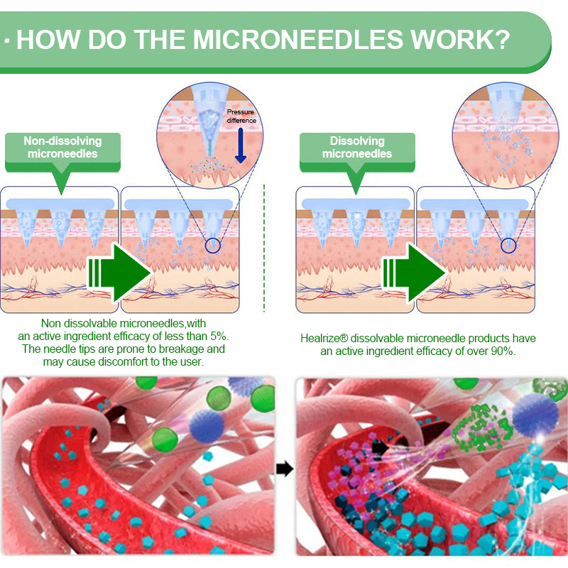 𝑶𝒇𝒇𝒊𝒄𝒊𝒂𝒍 𝑺𝒕𝒐𝒓𝒆| 👩‍⚕️𝐇e𝐚l𝐫i𝐳e®𝟏2-i𝐧-𝟏 M𝐨r𝐢n𝐠a * B𝐞r𝐛e𝐫i𝐧e * N𝐀D+ 𝐀d𝐯a𝐧c𝐞d N𝐚n𝐨 𝐌i𝐜r𝐨n𝐞e𝐝l𝐞 𝐏a𝐭c𝐡 (𝐎𝐧𝐜𝐞 𝐃𝐚𝐢𝐥𝐲, 𝐯𝐢𝐬𝐢𝐛𝐥𝐞 𝐜𝐡𝐚𝐧𝐠𝐞𝐬 𝐢𝐧 𝟕 𝐝𝐚𝐲𝐬）🗓️F𝐨r 𝐎𝐛𝐞𝐬𝐢𝐭𝐲, 𝐋o𝐨s𝐞 𝐒k𝐢n, 𝐃𝐢𝐚𝐛𝐞𝐭𝐞𝐬, 𝐒𝐥𝐞𝐞𝐩 𝐀𝐩𝐧𝐞𝐚, 𝐀𝐧𝐝 𝐉𝐨𝐢𝐧𝐭 𝐈𝐬𝐬𝐮𝐞𝐬🗓️