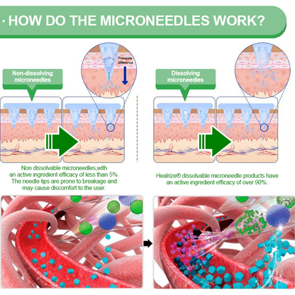 𝑶𝒇𝒇𝒊𝒄𝒊𝒂𝒍 𝑺𝒕𝒐𝒓𝒆| 👩‍⚕️𝐇e𝐚l𝐫i𝐳e®𝟏2-i𝐧-𝟏 M𝐨r𝐢n𝐠a * B𝐞r𝐛e𝐫i𝐧e * N𝐀D+ 𝐀d𝐯a𝐧c𝐞d N𝐚n𝐨 𝐌i𝐜r𝐨n𝐞e𝐝l𝐞 𝐏a𝐭c𝐡 (𝐎𝐧𝐜𝐞 𝐃𝐚𝐢𝐥𝐲, 𝐯𝐢𝐬𝐢𝐛𝐥𝐞 𝐜𝐡𝐚𝐧𝐠𝐞𝐬 𝐢𝐧 𝟕 𝐝𝐚𝐲𝐬）🗓️F𝐨r 𝐎𝐛𝐞𝐬𝐢𝐭𝐲, 𝐋o𝐨s𝐞 𝐒k𝐢n, 𝐃𝐢𝐚𝐛𝐞𝐭𝐞𝐬, 𝐒𝐥𝐞𝐞𝐩 𝐀𝐩𝐧𝐞𝐚, 𝐀𝐧𝐝 𝐉𝐨𝐢𝐧𝐭 𝐈𝐬𝐬𝐮𝐞𝐬🗓️